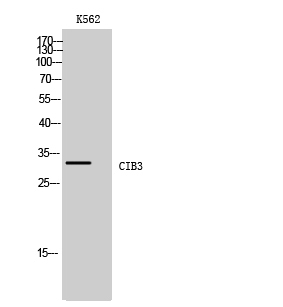 Fig. Western Blot analysis of K562 cells using CIB3 Polyclonal Antibody.