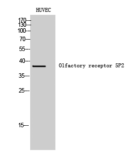 Fig. Western Blot analysis of HUVEC cells using Olfactory receptor 5P2 Polyclonal Antibody.