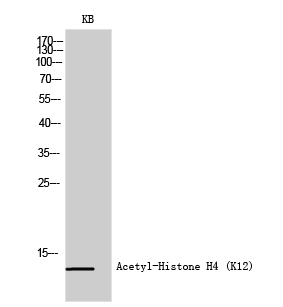 Fig.1. Western Blot analysis of KB cells using Acetyl-Histone H4 (K12) Polyclonal Antibody diluted at 1:500. Secondary antibody (catalog#: A21020) was diluted at 1:20000.