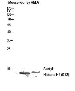 Fig.3. Western blot analysis of Mouse-kidney HELA lysis using Acetyl-Histone H4 (K12) antibody. Antibody was diluted at 1:500. Secondary antibody (catalog#: A21020) was diluted at 1:20000.