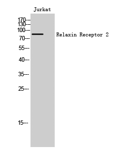 Fig. Western Blot analysis of Jurkat cells using Relaxin Receptor 2 Polyclonal Antibody.