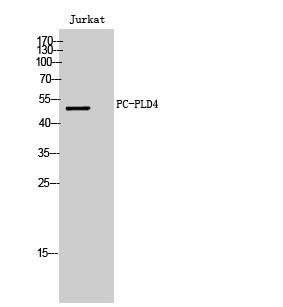 Fig. Western Blot analysis of Jurkat cells using PC-PLD4 Polyclonal Antibody.