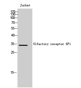 Fig. Western Blot analysis of Jurkat cells using Olfactory receptor 6P1 Polyclonal Antibody.