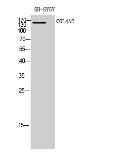 Fig.1. Western Blot analysis of SH-SY5Y cells using COL4A2 Polyclonal Antibody diluted at 1:2000.