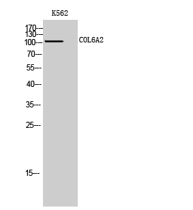 Fig. Western Blot analysis of K562 cells using COL6A2 Polyclonal Antibody.