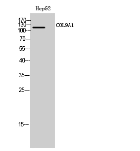 Fig. Western Blot analysis of HepG2 cells using COL9A1 Polyclonal Antibody.