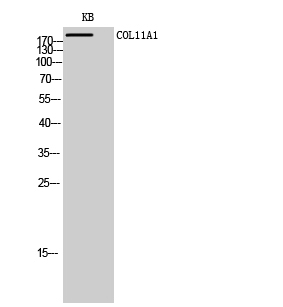 Fig. Western Blot analysis of KB cells using COL11A1 Polyclonal Antibody diluted at 1:1000.