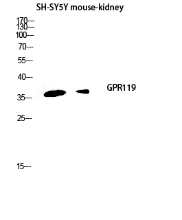 Fig.2. Western blot analysis of SH-SY5Y Mouse-kidney lysis using GPR119 antibody. Antibody was diluted at 1:1000.