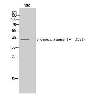 Fig. Western Blot analysis of VEC cells using Phospho-Casein Kinase Iα (Y321) Polyclonal Antibody.