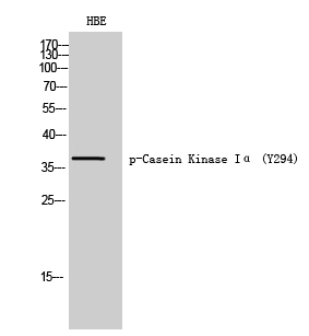 Fig. Western Blot analysis of HBE cells using Phospho-Casein Kinase Iα (Y294) Polyclonal Antibody diluted at 1:1000.