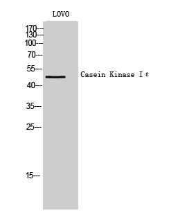 Fig. Western Blot analysis of LOVO cells using Casein Kinase Iε Polyclonal Antibody.