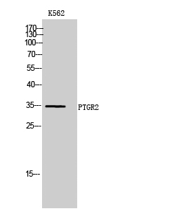 Fig. Western Blot analysis of K562 cells using PTGR2 Polyclonal Antibody.