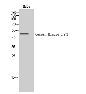Fig. Western Blot analysis of HeLa cells using Casein Kinase Iγ2 Polyclonal Antibody.