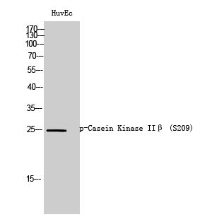 Fig. Western Blot analysis of HuvEc cells using Phospho-Casein Kinase IIβ (S209) Polyclonal Antibody.