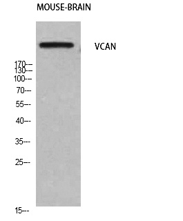 Fig. Western Blot analysis of Mouse-brain cells using Versican Polyclonal Antibody. Secondary antibody (catalog#: A21020) was diluted at 1:20000.