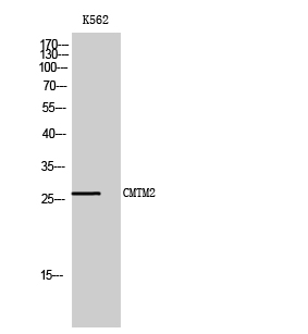 Fig. Western Blot analysis of K562 cells using CMTM2 Polyclonal Antibody.
