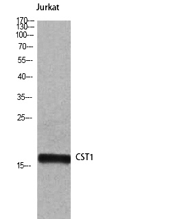 Fig. Western Blot analysis of Jurkat cells using Cystatin SN Polyclonal Antibody.