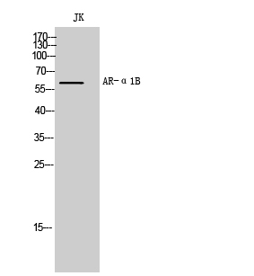 Fig. Western Blot analysis of JK cells using AR-α1B Polyclonal Antibody.