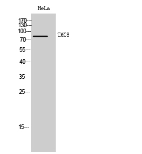 Fig. Western Blot analysis of HeLa cells using TMC8 Polyclonal Antibody. Secondary antibody (catalog#: A21020) was diluted at 1:20000.