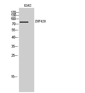 Fig. Western Blot analysis of K562 cells using ZNF420 Polyclonal Antibody. Secondary antibody (catalog#: A21020) was diluted at 1:20000.