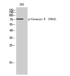 Fig. Western Blot analysis of 293 cells using Phospho-Catenin-β (Y654) Polyclonal Antibody.