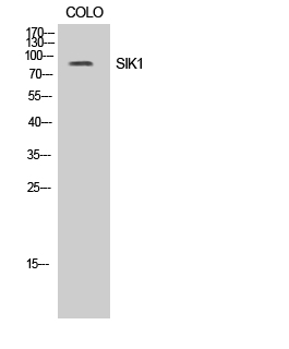 Fig. Western Blot analysis of COLO cells using SIK1 Polyclonal Antibody.