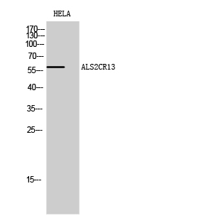 Fig.2. Western Blot analysis of HELA cells using ALS2CR13 Polyclonal Antibody diluted at 1:500.