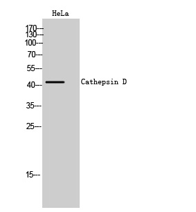 Fig. Western Blot analysis of HeLa cells using Cathepsin D Polyclonal Antibody.