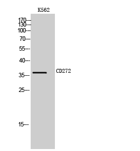 Fig. Western Blot analysis of K562 cells using CD272 Polyclonal Antibody.