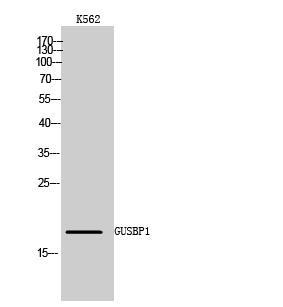 Fig. Western Blot analysis of K562 cells using GUSBP1 Polyclonal Antibody.