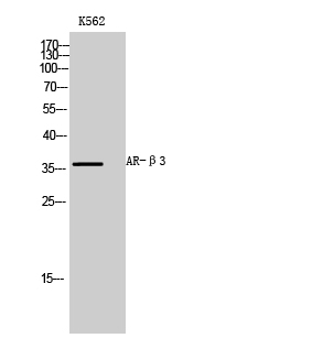 Fig.1. Western Blot analysis of K562 cells using AR-β3 Polyclonal Antibody diluted at 1:1000.