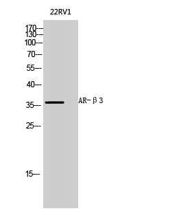Fig.2. Western Blot analysis of 22RV1 cells using AR-β3 Polyclonal Antibody diluted at 1:1000.