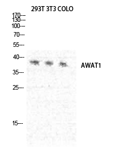 Fig.2. Western Blot analysis of 293T NIH-3T3 COLO cells using DGAT2L3 Polyclonal Antibody diluted at 1:1000.