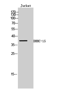 Fig.1. Western Blot analysis of Jurkat cells using DHHC-15 Polyclonal Antibody.