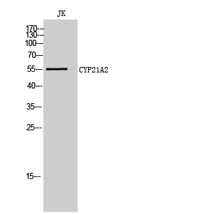 Fig. Western Blot analysis of JK cells using CYP21A2 Polyclonal Antibody.