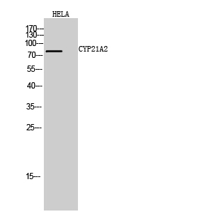 Fig. Western Blot analysis of HELA cells using CYP21A2 Polyclonal Antibody diluted at 1:1000.