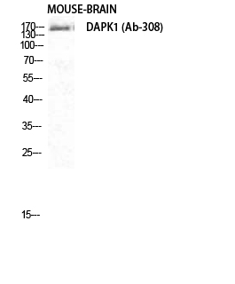 Fig. Western Blot analysis of Mouse-BRAIN cells using DAPK1 Polyclonal Antibody diluted at 1:1000.