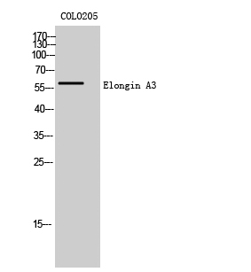 Fig. Western Blot analysis of COLO205 cells using Elongin A3 Polyclonal Antibody.
