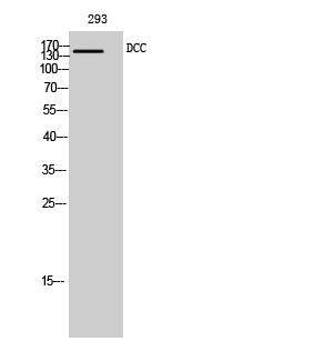 Fig. Western Blot analysis of 293 cells using DCC Polyclonal Antibody diluted at 1:500.