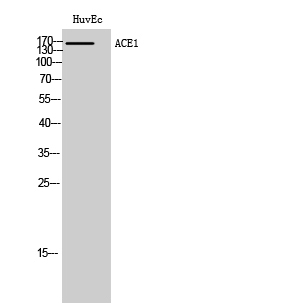 Fig. Western Blot analysis of HuvEc cells using ACE1 Polyclonal Antibody diluted at 1:1000.