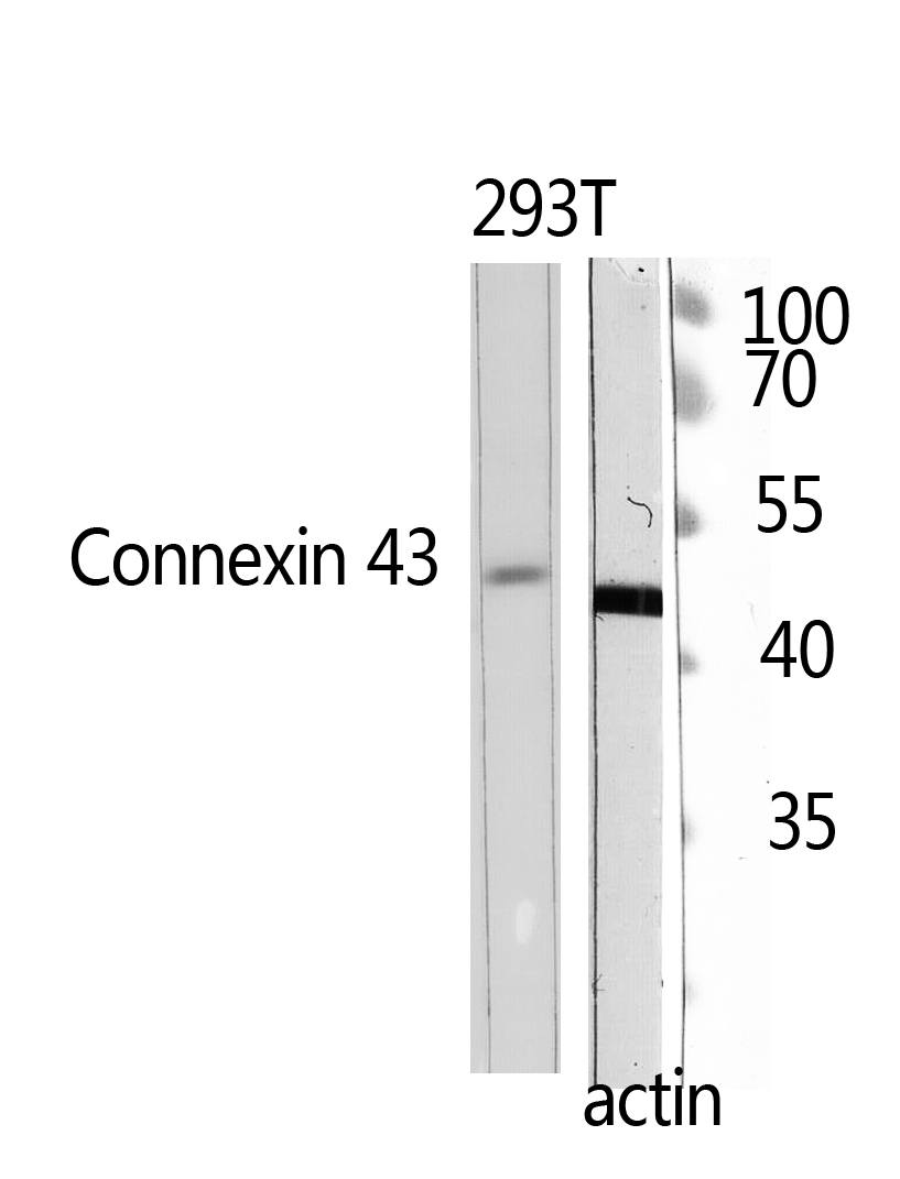 Fig.2. Western Blot analysis of 293T using Doublecortin Polyclonal Antibody. Antibody was diluted at 1:500.