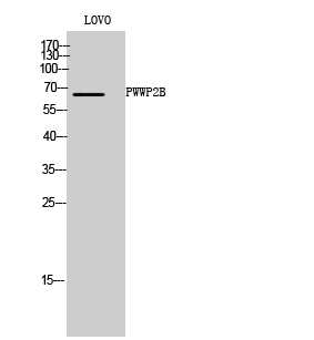 Fig. Western Blot analysis of LOVO cells using PWWP2B Polyclonal Antibody.