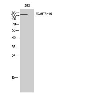 Fig. Western Blot analysis of 293 cells using ADAMTS-19 Polyclonal Antibody.