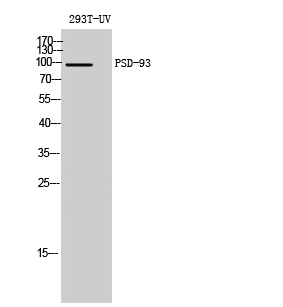 Fig. Western Blot analysis of 293T-UV cells using PSD-93 Polyclonal Antibody diluted at 1:1000.