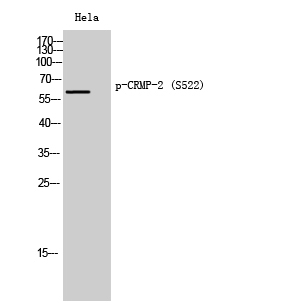 Fig. Western Blot analysis of Hela cells using Phospho-CRMP-2 (S522) Polyclonal Antibody diluted at 1:2000.