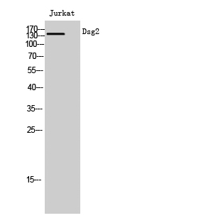 Fig. Western Blot analysis of Jurkat cells using Dsg2 Polyclonal Antibody.