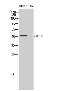 Fig. Western Blot analysis of HEPG2-UV cells using MKP-2 Polyclonal Antibody diluted at 1:1000.
