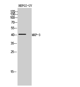 Fig. Western Blot analysis of HEPG2-UV cells using MKP-3 Polyclonal Antibody diluted at 1:500.