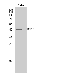 Fig. Western Blot analysis of COLO cells using MKP-4 Polyclonal Antibody diluted at 1:1000.