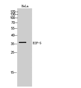 Fig. Western Blot analysis of HeLa cells using E2F-5 Polyclonal Antibody.